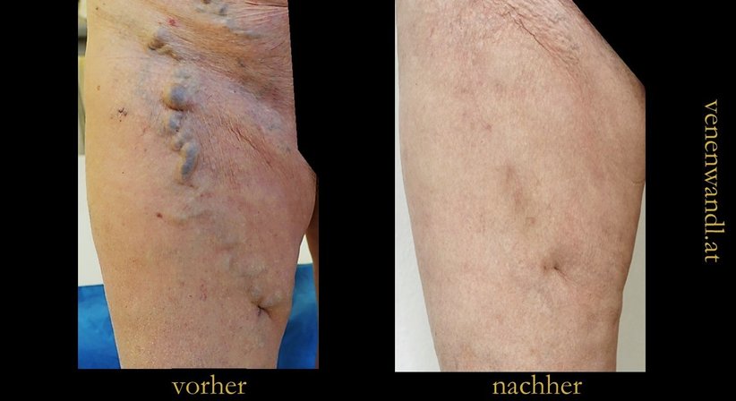 Dr. Ernst Wandl - Radiologe Linz 4020