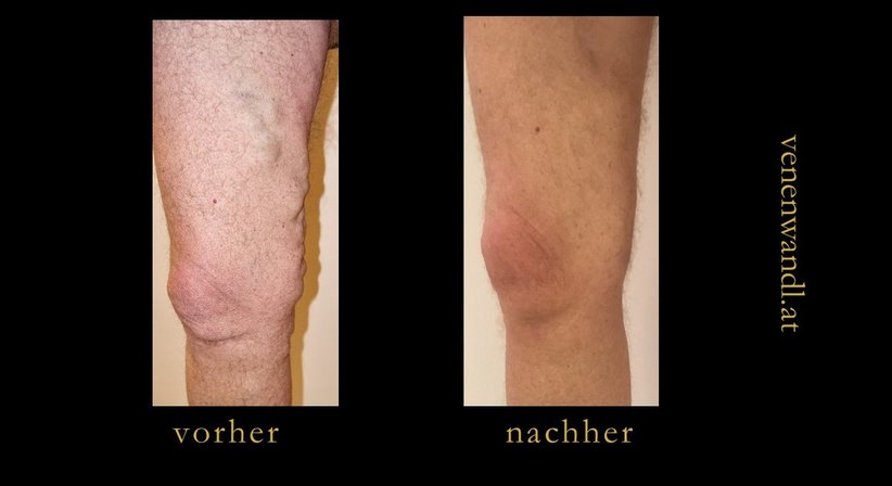 Dr. Ernst Wandl - Radiologe Linz 4020