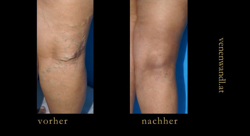 Dr. Ernst Wandl - Radiologe Linz 4020