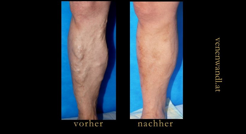 Dr. Ernst Wandl - Radiologe Linz 4020