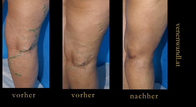 Dr. Ernst Wandl - Radiologe Linz 4020