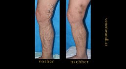 Dr. Ernst Wandl - Radiologe Linz 4020