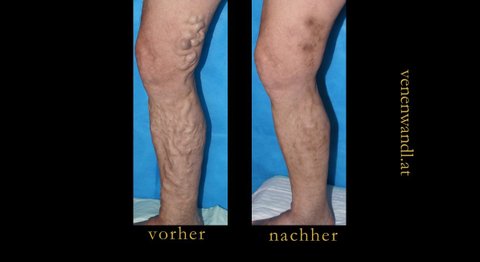 Praxis - Dr. Ernst Wandl - Radiologe Linz 4020