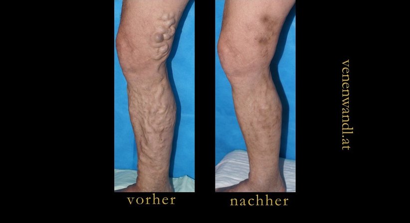 Dr. Ernst Wandl - Radiologe Linz 4020