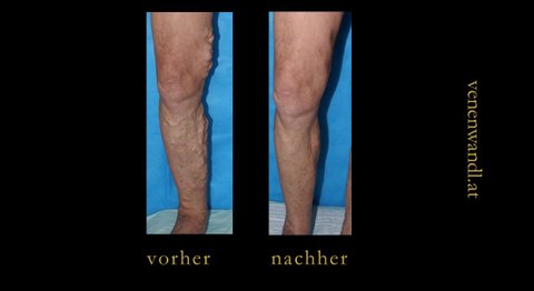 Praxis - Dr. Ernst Wandl - Radiologe Linz 4020