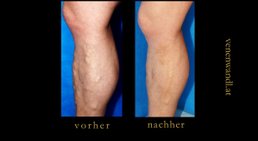 Dr. Ernst Wandl - Radiologe Linz 4020