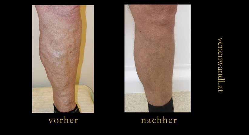 Dr. Ernst Wandl - Radiologe Linz 4020