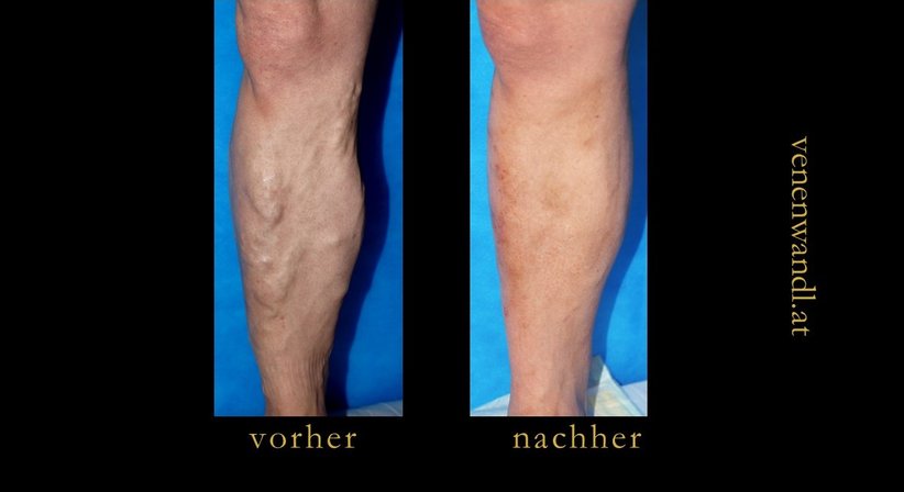 Dr. Ernst Wandl - Radiologe Linz 4020