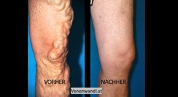 Dr. Ernst Wandl - Radiologe Linz 4020