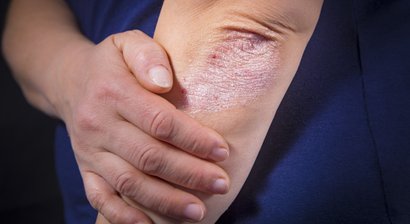 Allgemeine Dermatologie