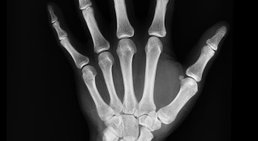 Dr. Karin Stengg, D.O. - Unfallchirurgin Wien 1010