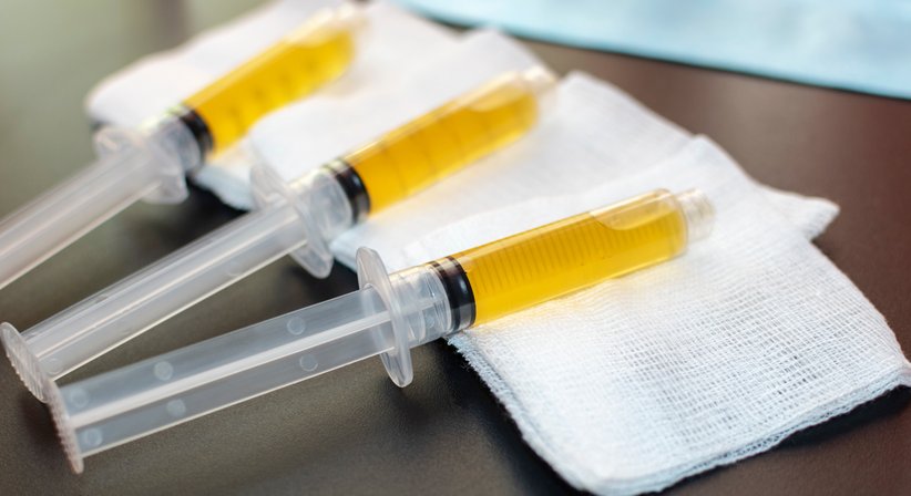 ACP-Therapie - Dr. Marie Sophie Asmus - Orthopädin Wien 1090