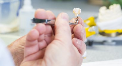 Inlays / Onlays / Overlays