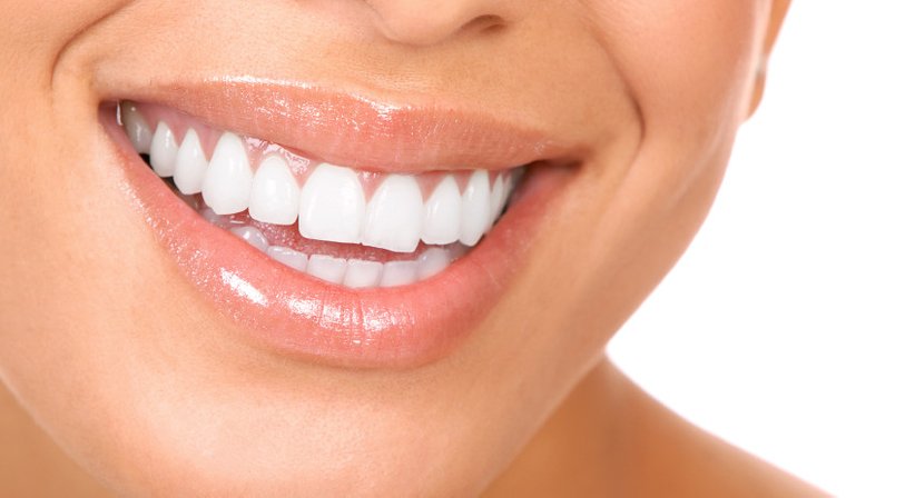 Unsichtbare Zahnregulierung - DDr. Alexandra Draskovits - Zahnärztin Wien 1210