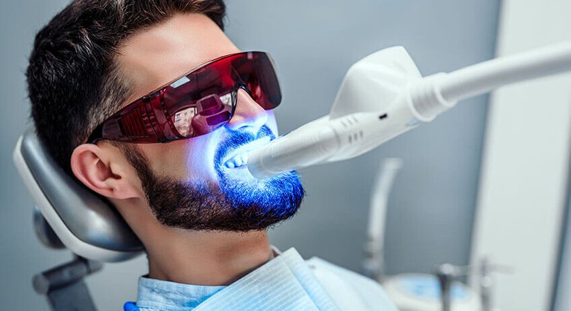 Bleaching - DDr. Stefanie Weber - Zahnärztin Wien 1010