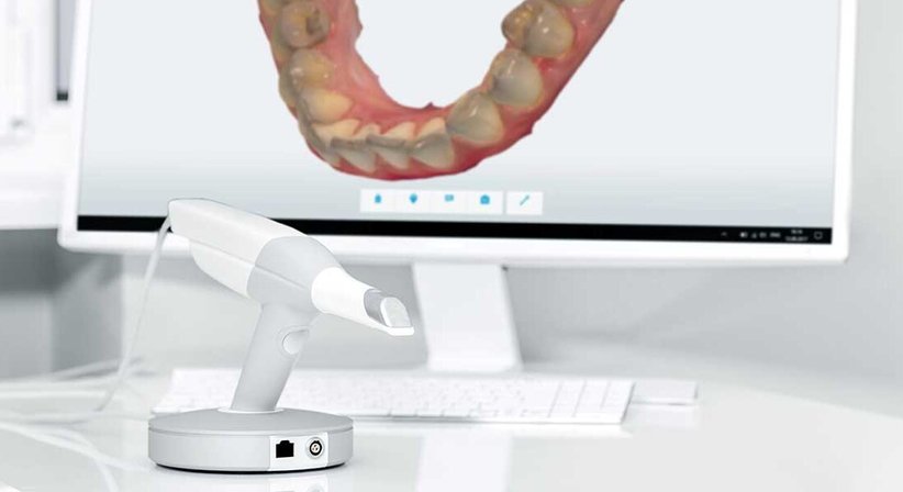 Intraoralscanner - DDr. Stefanie Weber - Zahnärztin Wien 1010