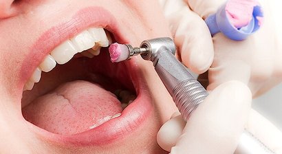 Professionelle Mundhygiene / Zahnprophylaxe