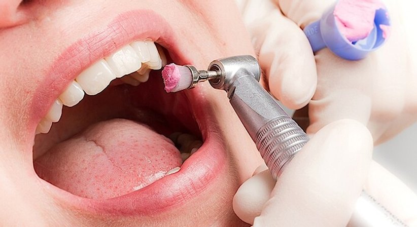 Professionelle Mundhygiene / Zahnprophylaxe - DDr. Stefanie Weber - Zahnärztin Wien 1010