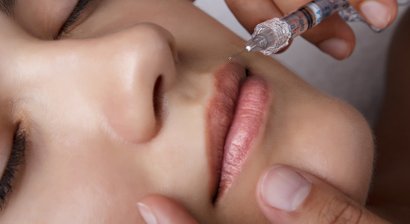 Lippenunterspritzung