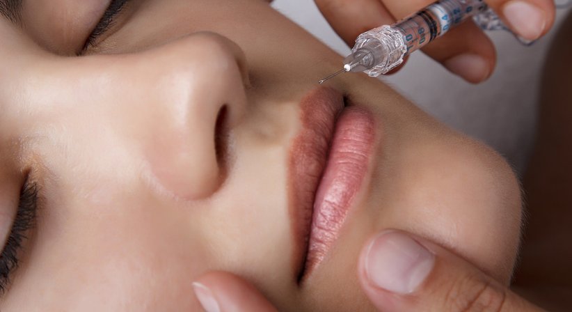 Lippenunterspritzung - Dr. Christoph Grill - Plastischer Chirurg Wien 1010