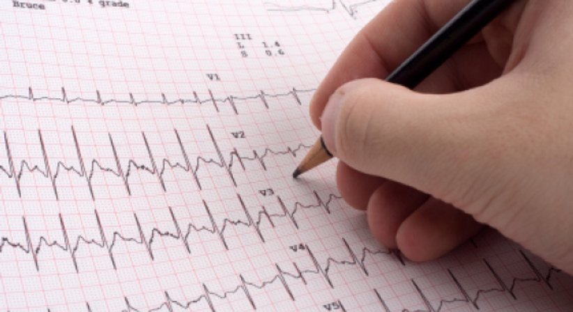 EKG/Langzeit-EKG - Prim.Univ.-Prof. Dr. Michael Hirschl - Internist Eggenburg 3730