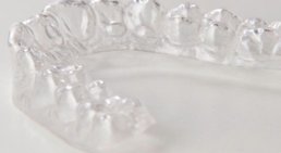 Unsichtbare Zahnspange (Aligner) -