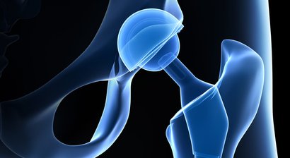 Hüftgelenksendoprothese