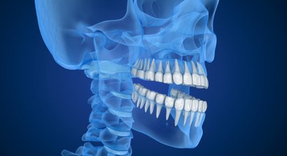 3D-navigierte Implantation