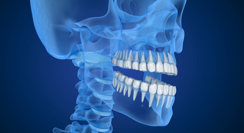 3D-navigierte Implantation - Univ.-Ass. DDr. Alexander Zimmermann - Zahnarzt Wien 1080