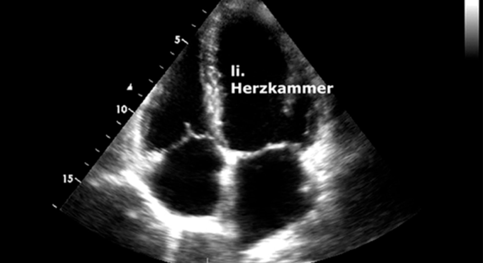 Dr. Ilyas Kozanli Herzultraschall (HerzEcho) Internist in 1190