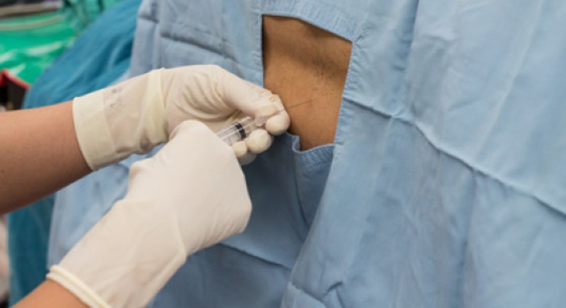 Infiltrationen der Wirbelsäule und Nerven im Röntgen oder CT-gesteuert - OA Dr. med. Nazem Atassi - Neurochirurg Wien 1190