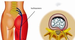 OA Dr. med. Nazem Atassi - Neurochirurg Wien 1190