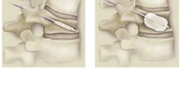 OA Dr. med. Nazem Atassi - Neurochirurg Wien 1190