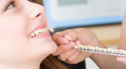 Veneers (Micro Veneers)