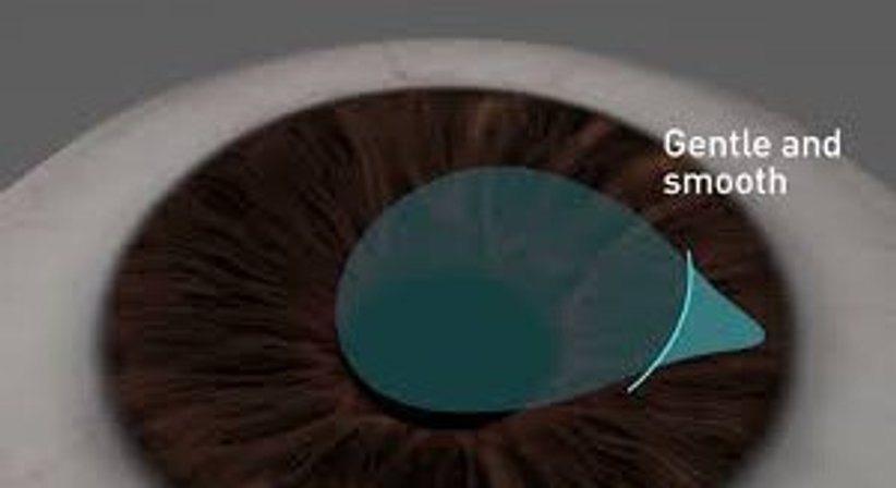 SmartSight Lentikelextraktion / Augenlasern ohne Flap - Dr. Victor Derhartunian, FEBO - Augenarzt Wien 1010