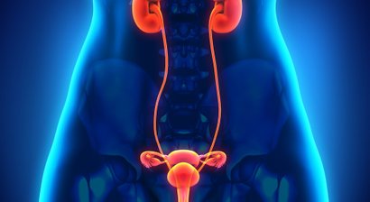 Therapie von Zysten, PCO Syndrom, Myomen, Polypen