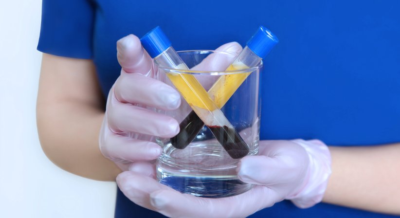 Eigenblutbehandlung (PRP-Therapie) - Prim. Dr. Thomas Hofstädter - Orthopäde Salzburg 5020