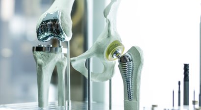 Komplexe Revisionsoperationen an Hüfte und Knie