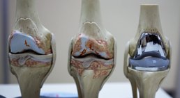 Prim. Dr. Thomas Hofstädter - Orthopäde Salzburg 5020