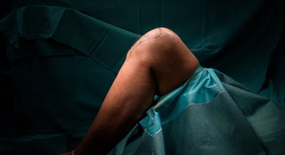 Kniearthroskopie (Gelenkspiegelung Knie)