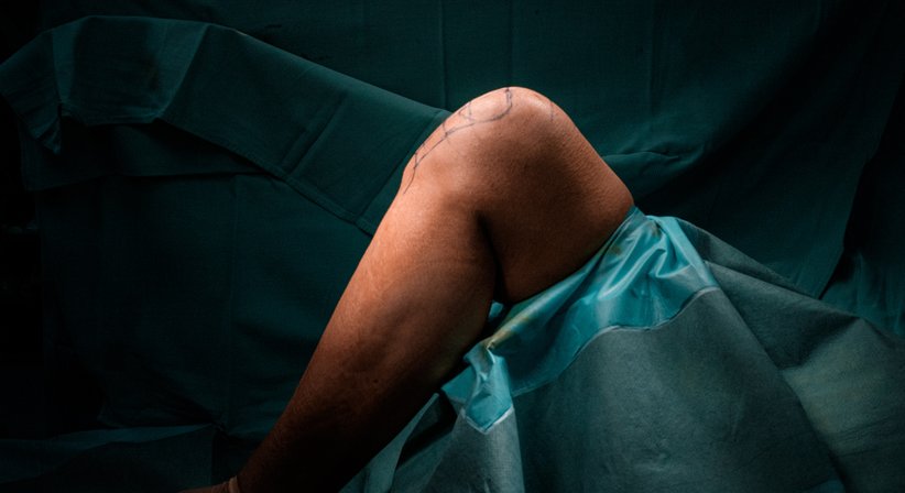 Kniearthroskopie (Gelenkspiegelung Knie) - Prim. Dr. Thomas Hofstädter - Orthopäde Salzburg 5020