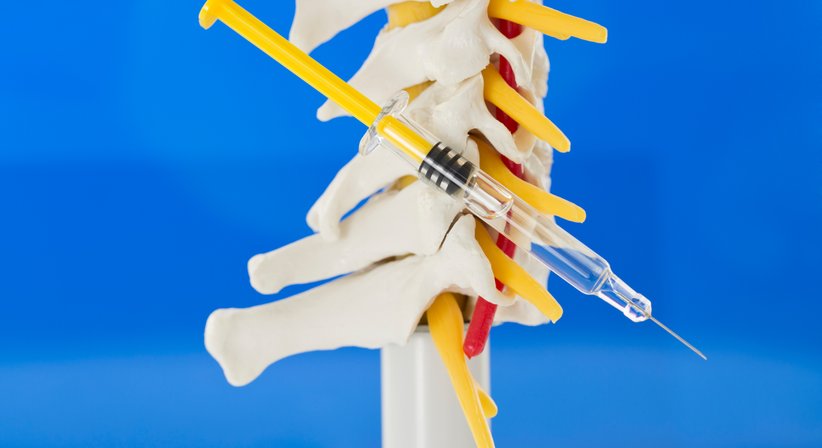 Infiltrationen sämtlicher Gelenke - Prim. Dr. Thomas Hofstädter - Orthopäde Salzburg 5020