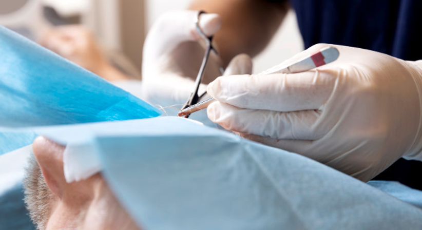 Operative Dermatologie bei Praxis am Kärntner Ring