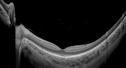 Vollständige Augenuntersuchung und Brillenbestimmung