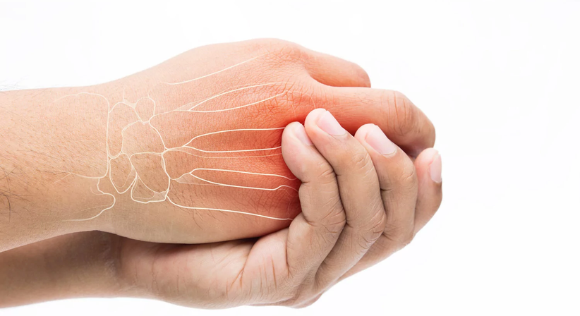 Arthrose (Degenerative Gelenkerkrankung) - Dr. Manuel Becede - Rheumatologe Tulln an der Donau 3430