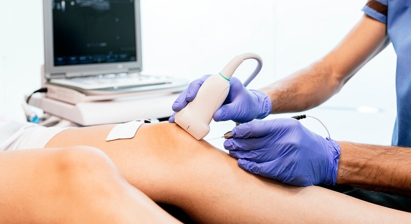 Gelenkpunktion und -infiltration - Dr. Manuel Becede - Rheumatologe Tulln an der Donau 3430