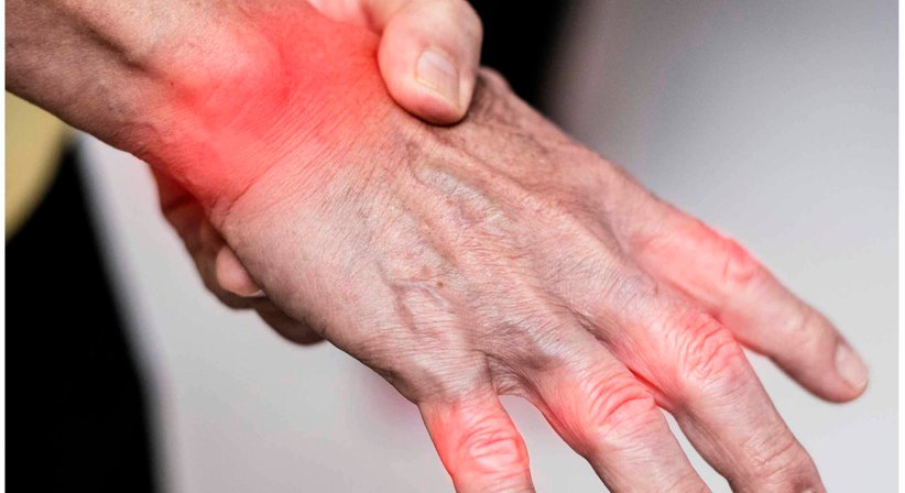 Gicht - Dr. Manuel Becede - Rheumatologe Tulln an der Donau 3430