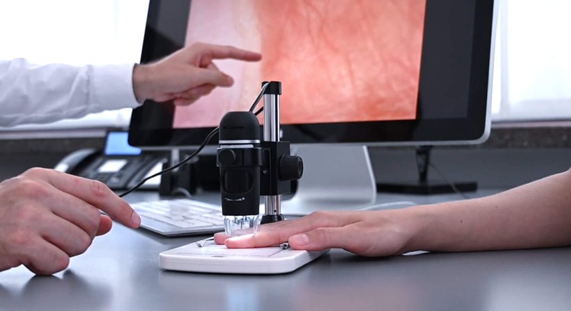 Kapillarmikroskopie - Dr. Manuel Becede - Rheumatologe Tulln an der Donau 3430