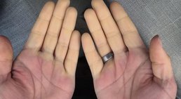 Dr. Manuel Becede - Rheumatologe Tulln an der Donau 3430