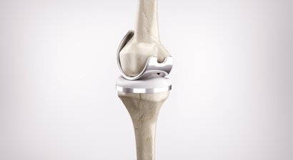 Knieprothese / Teilprothese und Total-Endoprothese (Knie-TEP)